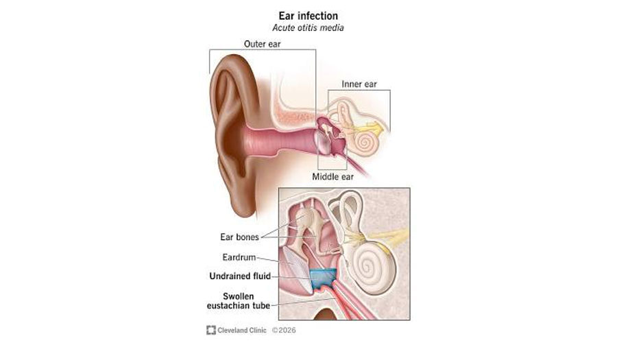 Ear fitness exercises
